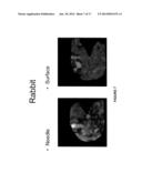 Novel Needle Driver For Magnetic Resonance Elastography diagram and image