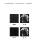 DIAGNOSTIC AND TREATMENT METHODS USING COHERENT ANTI-STOKES RAMAN     SCATTERING (CARS)-BASED MICROENDOSCOPIC SYSTEM diagram and image