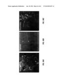 DIAGNOSTIC AND TREATMENT METHODS USING COHERENT ANTI-STOKES RAMAN     SCATTERING (CARS)-BASED MICROENDOSCOPIC SYSTEM diagram and image