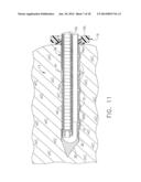 BIOPSY DEVICE WITH VACUUM ASSISTED BLEEDING CONTROL diagram and image