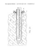 BIOPSY DEVICE WITH VACUUM ASSISTED BLEEDING CONTROL diagram and image