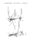 PELVIC DIGITIZER DEVICE WITH INERTIAL SENSOR UNIT AND METHOD diagram and image