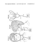 ORAL MOUTHPIECE AND METHOD FOR THE USE THEREOF diagram and image