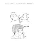 ORAL MOUTHPIECE AND METHOD FOR THE USE THEREOF diagram and image