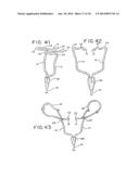 ORAL MOUTHPIECE AND METHOD FOR THE USE THEREOF diagram and image