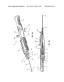 Catheter Placement Device and Method diagram and image