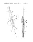 Catheter Placement Device and Method diagram and image