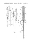 Catheter Placement Device and Method diagram and image