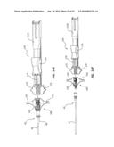 Catheter Placement Device and Method diagram and image