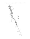 Catheter Placement Device and Method diagram and image