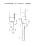 Catheter Placement Device and Method diagram and image