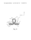 ABSORBENT ARTICLE COMPRISING FLUID HANDLING ZONES diagram and image