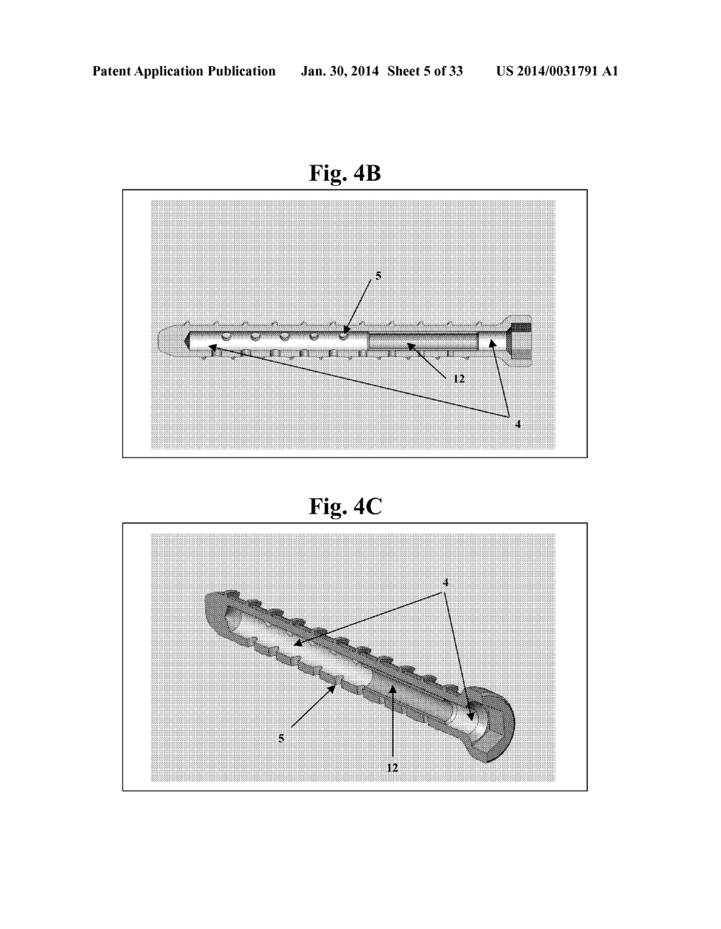 BONE SCREWS AND METHODS OF USE THEREOF - diagram, schematic, and image 06