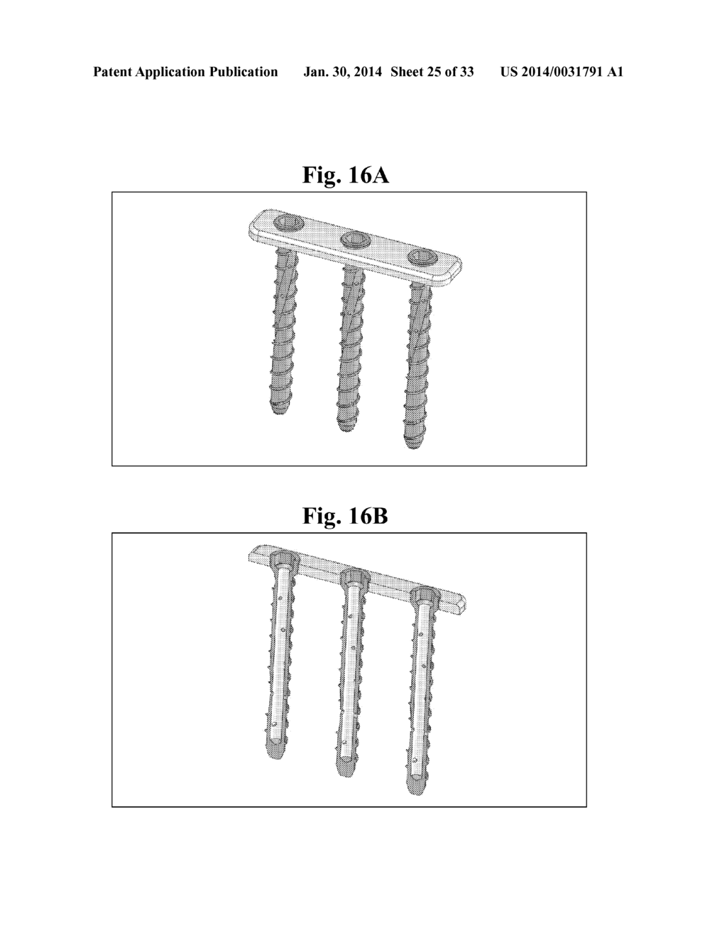 BONE SCREWS AND METHODS OF USE THEREOF - diagram, schematic, and image 26