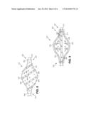 Catheters and Methods for the Treatment of Bodily Passages diagram and image