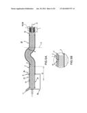 CATHETER WITH RETRACTABLE COVER AND PRESSURIZED FLUID diagram and image