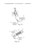 GUIDED CARDIAC ABLATION CATHETERS diagram and image