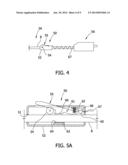 Material Removal Device and Method of Use diagram and image