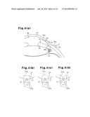 MEDICAL KNIFE diagram and image