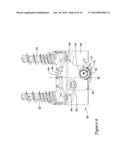 BONE STABILIZATION MEMBER WITH BONE SCREW RETENTION MECHANISM diagram and image