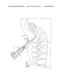 SPINAL FIXATION TOOL SET AND METHOD diagram and image