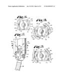 Spinal fixation tool set and method diagram and image