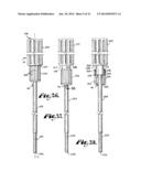 Spinal fixation tool set and method diagram and image