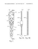 Method of reduction of proximal humeral fracture diagram and image