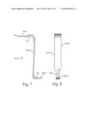 Method of reduction of proximal humeral fracture diagram and image