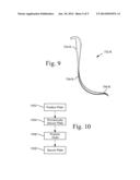 Method of reduction of proximal humeral fracture diagram and image