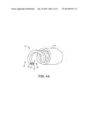 MAGNETIC RESONANCE IMAGING COMPATIBLE MEDICAL ELECTRICAL LEAD AND METHOD     OF MAKING THE SAME diagram and image