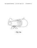 MAGNETIC RESONANCE IMAGING COMPATIBLE MEDICAL ELECTRICAL LEAD AND METHOD     OF MAKING THE SAME diagram and image