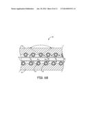 MAGNETIC RESONANCE IMAGING COMPATIBLE MEDICAL ELECTRICAL LEAD AND METHOD     OF MAKING THE SAME diagram and image