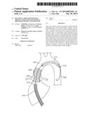 Delivery Catheter With Distal Moving Capsule for Transapical Prosthetic     Heart Valve Delivery diagram and image