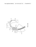 Delivery Catheter With Distal Moving Capsule for Transapical Prosthetic     Heart Valve Delivery diagram and image