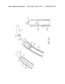 Delivery Catheter With Distal Moving Capsule for Transapical Prosthetic     Heart Valve Delivery diagram and image