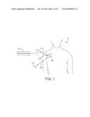 Techniques for Data Retention upon Detection of an Event in an Implantable     Medical Device diagram and image