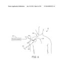 Techniques for Data Retention upon Detection of an Event in an Implantable     Medical Device diagram and image