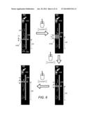 Displaying Computer-Aided Detection Information With Associated Breast     Tomosynthesis Image Information diagram and image