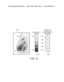 Displaying Computer-Aided Detection Information With Associated Breast     Tomosynthesis Image Information diagram and image