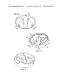 POWDER DISPERSION APPARATUS, METHOD OF MAKING AND USING THE APPARATUS, AND     COMPONENTS THAT CAN BE USED ON THE APPARATUS AND OTHER DEVICES diagram and image