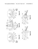 Oral Interface and Method using the Same diagram and image