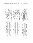 Oral Interface and Method using the Same diagram and image