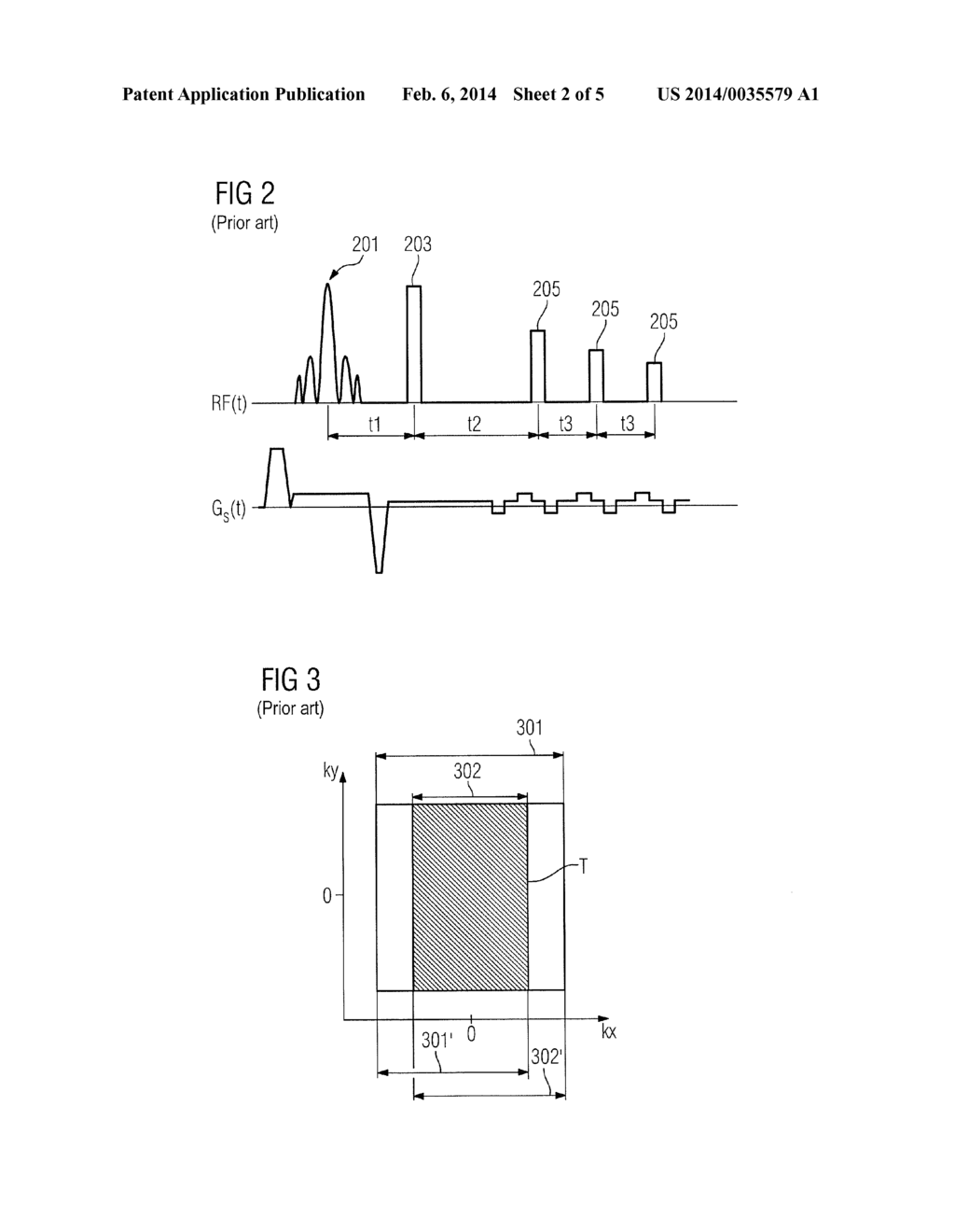 METHOD AND APPARATUS FOR ACQUISITION OF MAGNETIC RESONANCE DATA - diagram, schematic, and image 03