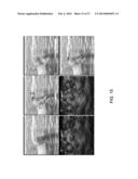 SYSTEM AND METHOD FOR NORMALIZING RANGE IN AN OPTOACOUSTIC IMAGING SYSTEM diagram and image