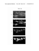 APPARATUS AND METHOD FOR ANALYZING LESIONS IN MEDICAL IMAGE diagram and image