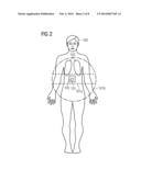 METHOD FOR MOVEMENT-AVERAGED ATTENUATION CORRECTION AND MAGNETIC RESONANCE     SYSTEM diagram and image