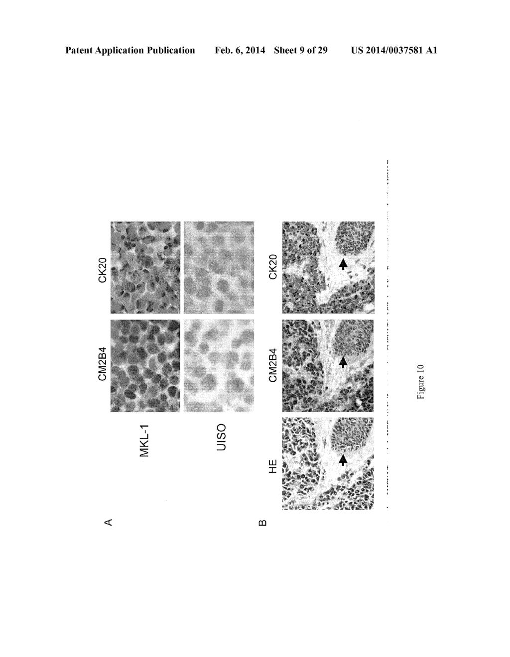 METHODS TO DIAGNOSE AND IMMUNIZE AGAINST THE VIRUS CAUSING HUMAN MERKEL     CELL CARCINOMA - diagram, schematic, and image 10