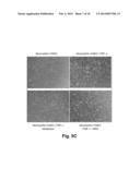 Use of Stem Cells to Reduce Leukocyte Extravasation diagram and image