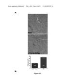 MITIGATING TISSUE DAMAGE AND FIBROSIS VIA LATENT TRANSFORMING GROWTH     FACTOR BETA BINDING PROTEIN (LTBP4) diagram and image